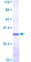 12.5% SDS-PAGE Stained with Coomassie Blue.